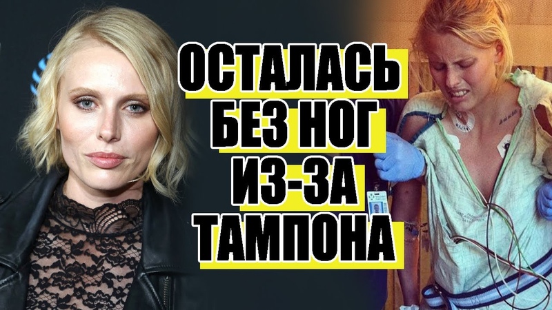 История модели Лорен Вассер, потерявшей ноги из за