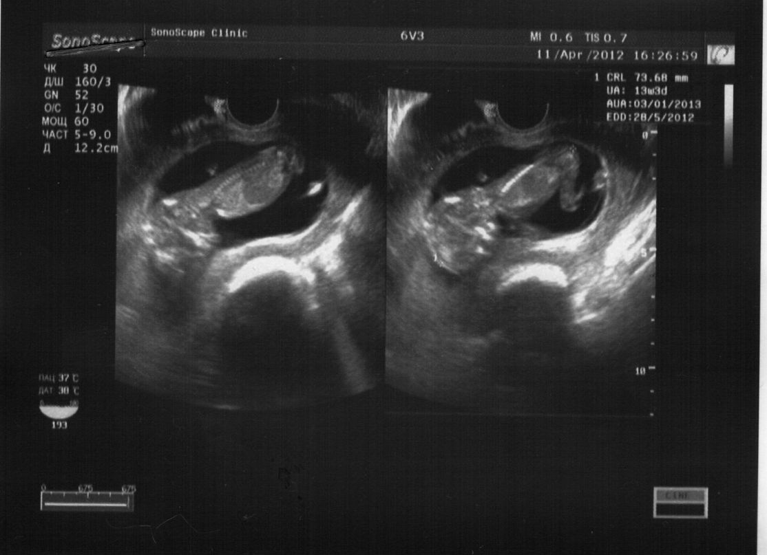 Алексей Лобанов | Санкт-Петербург