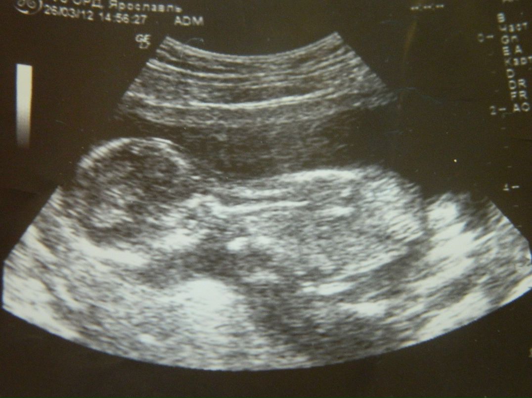 Дима Чухнов | Данилов